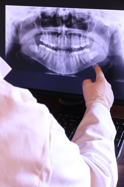 Best Broken or Chipped Tooth Repair in Clever, MO
