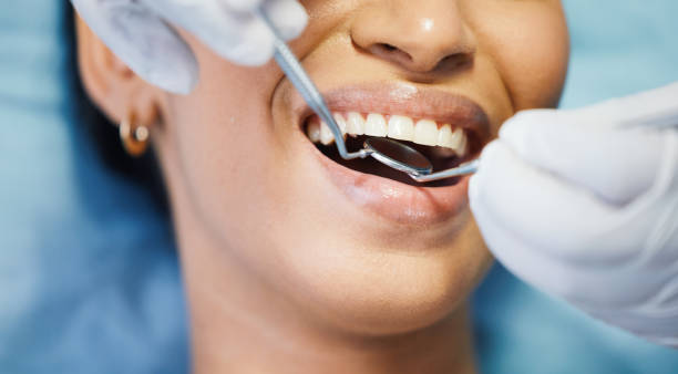 Best Emergency Dental Care for Sports Injuries in Clever, MO