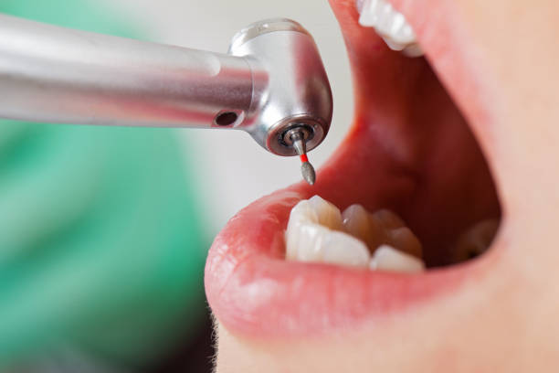 Best Emergency Treatment for Jaw Pain or Injury in Clever, MO